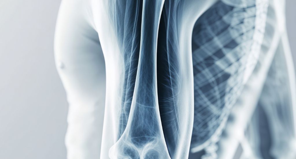 Come rafforzare le ossa in inverno